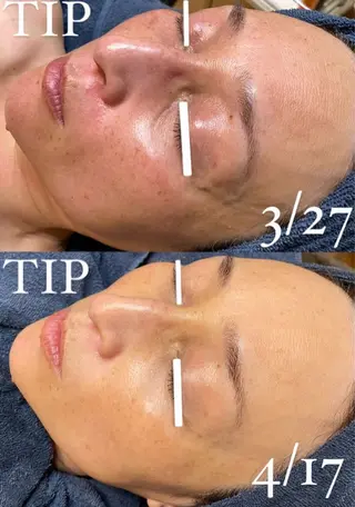 ソリッジ肌管理室所属・山村 有花のエステ・リラクイメージ