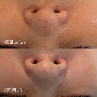 エステティックサロン Liente(リアンテ)所属・Hashimoto .のエステ・リラクイメージ