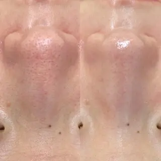 プライベートサロン リプレイスのエステ・リラクイメージ