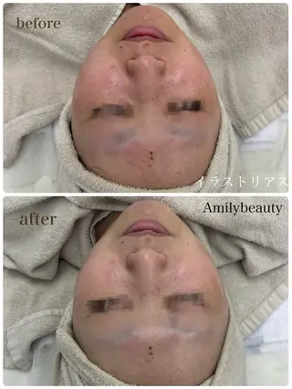 Amilybeauty所属・Amily beauty 毛利のその他イメージ