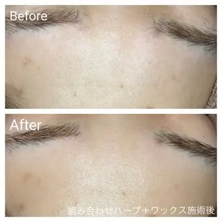 深い肌悩み専門 フェイシャルサロンのエステ・リラクイメージ