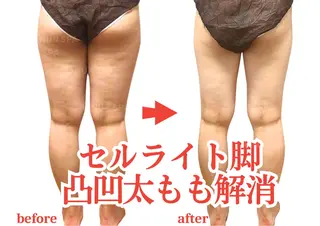 本気のリンパ痩身 ♦︎ラナンスパのエステ・リラクイメージ