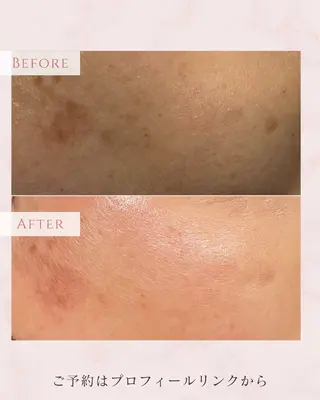 肌育フェイシャル🌿 noel🌿SAKIのエステ・リラクイメージ