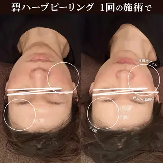 トータルビューティー kinoseのエステ・リラクイメージ