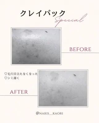 フェイシャルエステ♡ KAORIのエステ・リラクイメージ