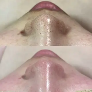 美肌脱毛&毛穴専門 Nico🐰ྀི♡のエステ・リラクイメージ