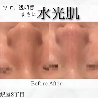 Ginza Charerのエステ・リラクイメージ