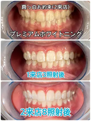 Platinum Beauty 四条烏丸店所属・吉田亮利 ホワイトニング専門店のその他イメージ