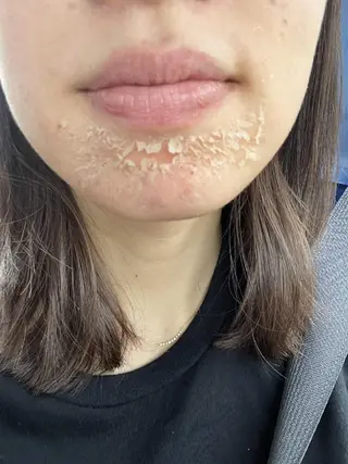 アロハーブ 韓国肌管理のエステ・リラクイメージ