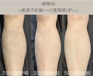 メンズ 脱毛&ビューティー A'nJUDYの眉毛・アイブロウイメージ