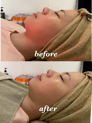 メンズ 腸活サポート みなみののエステ・リラクイメージ