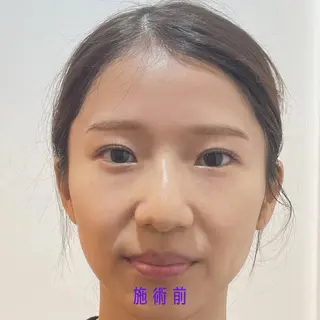 Nexfit for Beauty小顔矯正のエステ・リラクイメージ