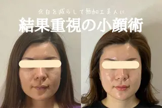 最速小顔・肌質管理 espoirマキのエステ・リラクイメージ