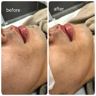 キッズ N.Sサロン Miyauchiのエステ・リラクイメージ