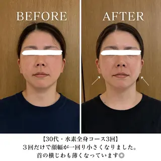 【三軒茶屋/下馬】 本格痩身・よもぎ蒸しのエステ・リラクイメージ