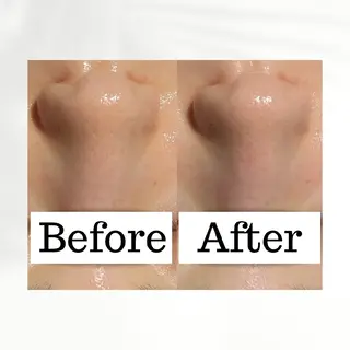 肌管理専門！BACI 加盟店LUANAのエステ・リラクイメージ