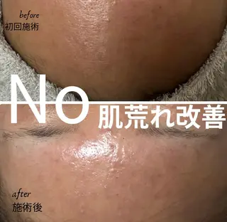 ニキビ毛穴専門店Beautysalon Luana所属・小林 まいのエステ・リラクイメージ