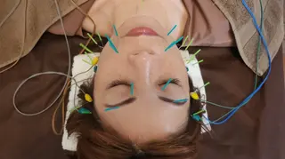 即効⚡小顔美容鍼🪡 むくみたるみ脂肪解消のエステ・リラクイメージ