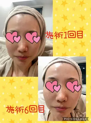 まつ毛パーマ・美肌 ナチュラル　ボーテのマツエク・マツパデザイン