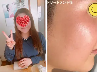 ノエビアビューティースタジオセレンディピティ所属・ノエビアビューティー セレンディピティのエステ・リラクイメージ