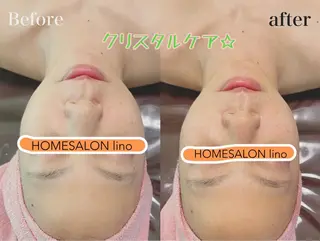 HOME SALON linoのエステ・リラクイメージ