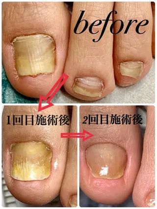 ネイル メンズトータルビューティーwellnessMARCA所属・【メンズ美容】 三浦かえでのネイルデザイン