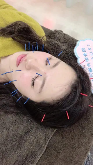 やまだ鍼灸接骨院（やまだしんきゅうせっこついん）所属・山田 晃のエステ・リラクイメージ