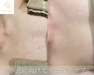 サロンドレナ名駅店所属・ハーブピーリング専門 サロンドレナ平岡のエステ・リラクイメージ