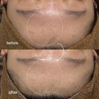 ENCHANT Kaede/肌質改善のその他イメージ