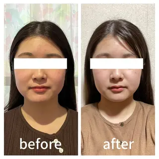 小顔サロン AMYONのエステ・リラクイメージ