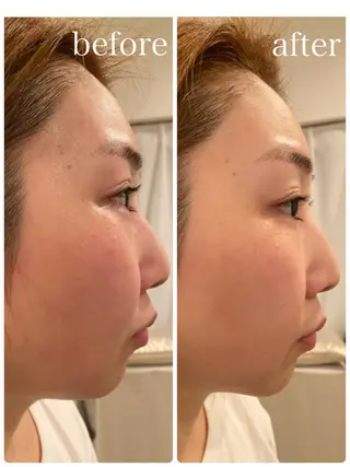 姿勢改善&beauty salon LAUB所属・姿勢改善 サロンLAUB奥村のエステ・リラクイメージ