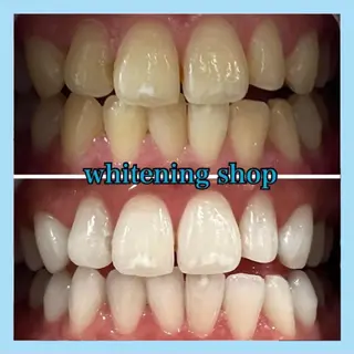 ホワイトニング ショップ千葉店のその他イメージ