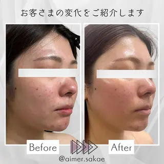 aimer 佐々木のエステ・リラクイメージ