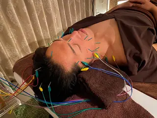 メンズ 即小顔♥️美容鍼× ハーブピーリングのその他イメージ