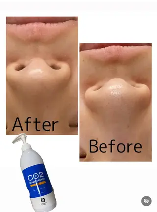 【敏感肌管理×小顔サロン】Belle orchid所属・敏感肌×小顔サロン 玲央奈のエステ・リラクイメージ