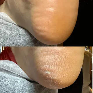 ROUN' 齋藤のエステ・リラクイメージ