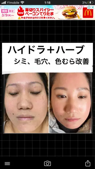 ショート カラー パーマ ヘアアレンジ メンズ キッズ ネイル マツエク・マツパ アイブロウ ハーブピーリング専門 🌿モッカのエステ・リラクイメージ