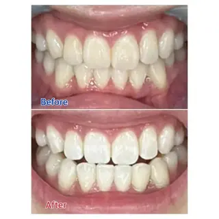 M渋谷店所属・M渋谷 ホワイトニングのエステ・リラクイメージ