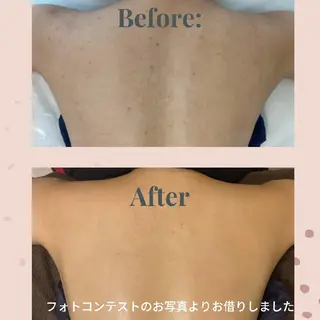 Cantik Cantik チャンティチャンティ所属・高橋 志保のエステ・リラクイメージ