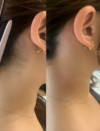 韓国肌管理Cocoh ハーブピーリングのエステ・リラクイメージ