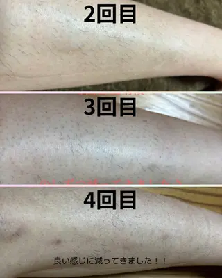 メンズ macheriena りなのエステ・リラクイメージ