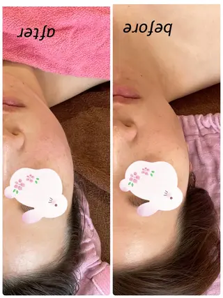 SINCERE MIYUKIのエステ・リラクイメージ