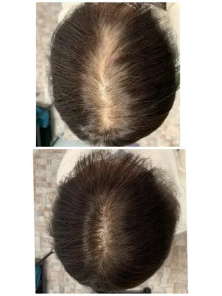 ショート ヘアアレンジ Kanal Kanaのエステ・リラクイメージ