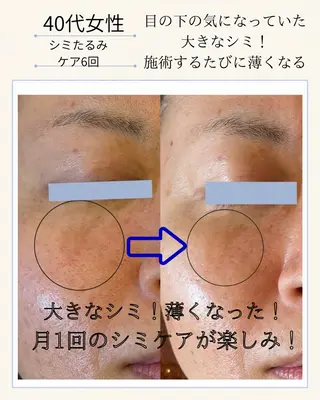 エステサロン グラマラスのエステ・リラクイメージ