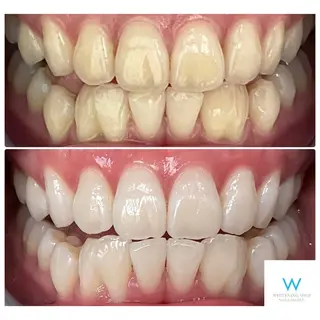 ホワイトニングショップ奈良生駒店所属・乾 理望のエステ・リラクイメージ