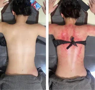 セルライトクラッシュ 腸もみ bi♡eruのエステ・リラクイメージ