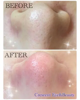 Crescent Beautyのエステ・リラクイメージ