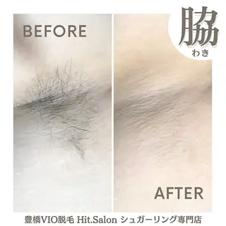 Hit. シュガーリング豊橋のエステ・リラクイメージ