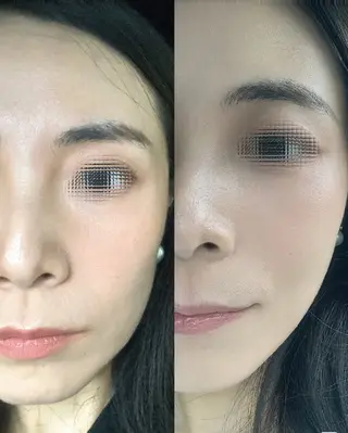 マツエク・マツパ aliaハイフ&水光ジェットサロン所属・aliaハーブ水光店 エステティシャン募集のエステ・リラクイメージ