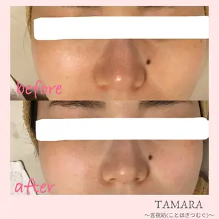 TAMARA 松下のエステ・リラクイメージ